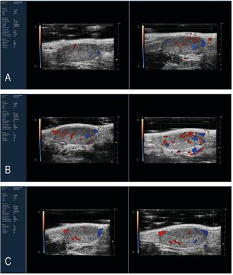 Effects of Oral Administration of Lepidium meyenii on Morphology of Mice Testis and Motility of Epididymal Sperm Cells After Tetrahydrocannabinol Exposure